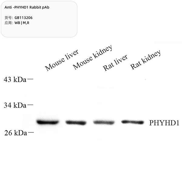 Антитела первичные, поликлональные, PHYHD1, 100 мкл