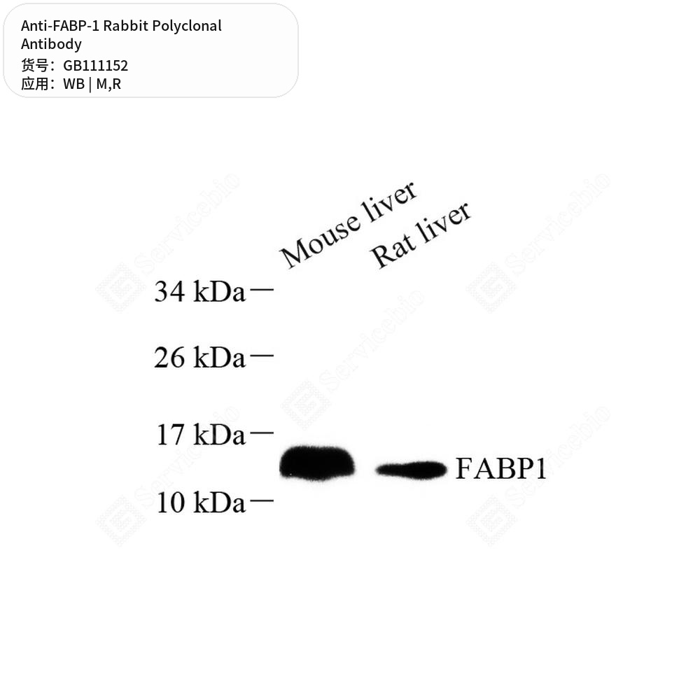 Антитела первичные, поликлональные кролика к FABP-1 крысы, мыши, 100 мкл