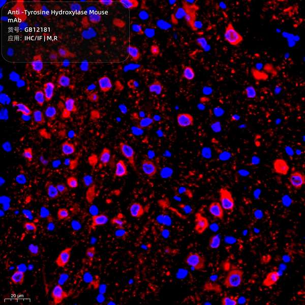 Антитела первичные, моноклональные, Tyrosine Hydroxylase, 100 мкл