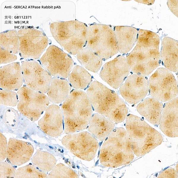 Антитела первичные, поликлональные, SERCA2 ATPase, 100 мкл