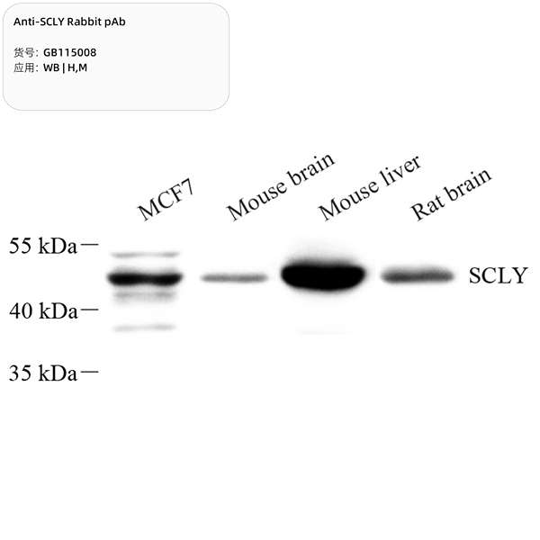 Антитела первичные, поликлональные, SCLY, 100 мкл
