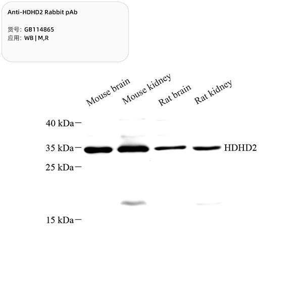 Антитела первичные, поликлональные, HDHD2, 100 мкл