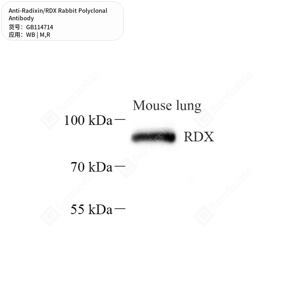 Антитела первичные, поликлональные кролика к Radixin/RDX крысы, мыши, 50 мкл