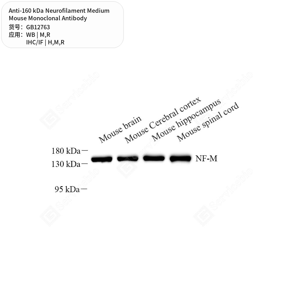 Антитела первичные, моноклональные мыши к 160 kDa Neurofilament Medium крысы, мыши, чел., 50 мкл