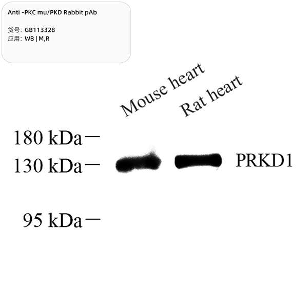Антитела первичные, поликлональные, PKC mu/PKD, 100 мкл