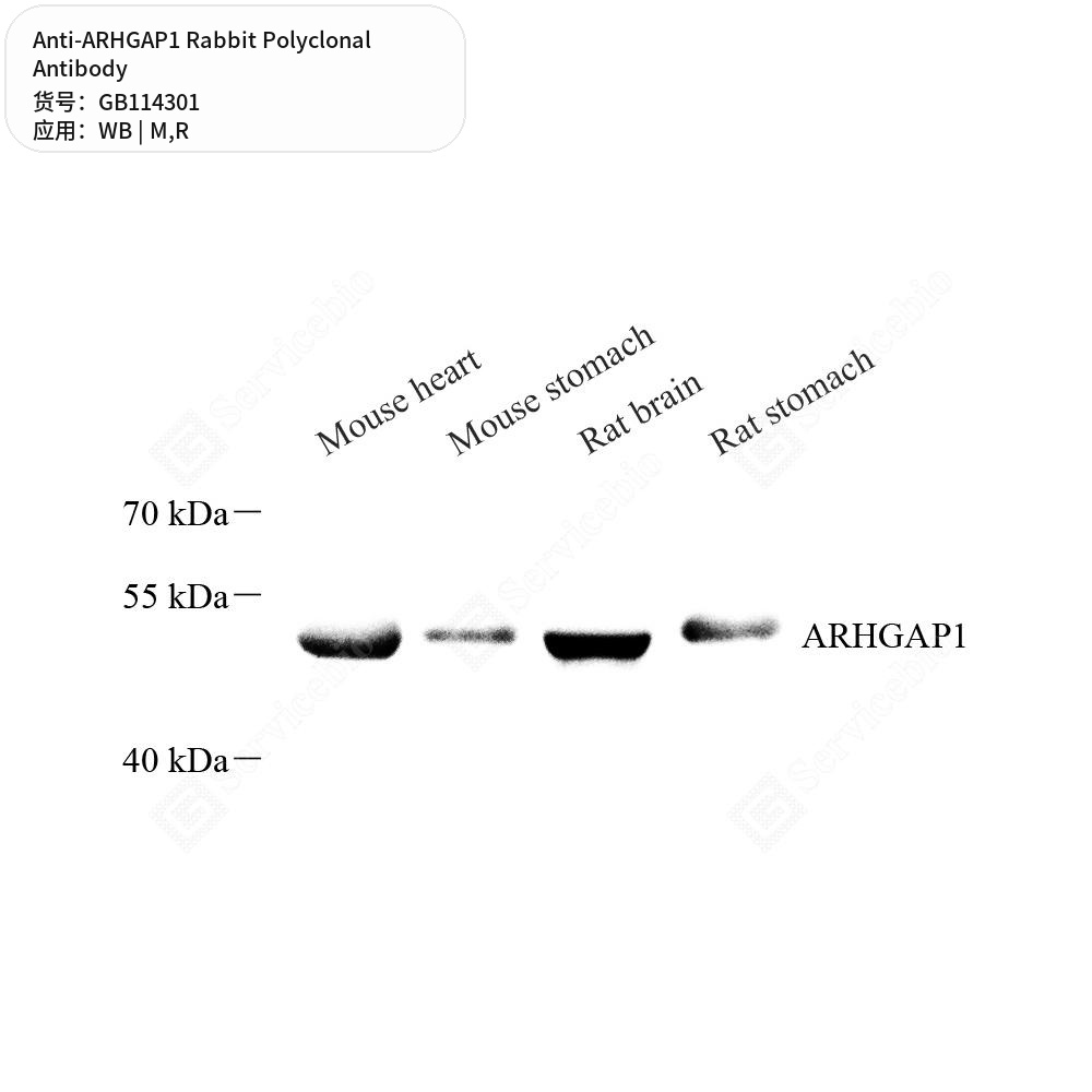 Антитела первичные, поликлональные кролика к ARHGAP1 крысы, мыши, 50 мкл