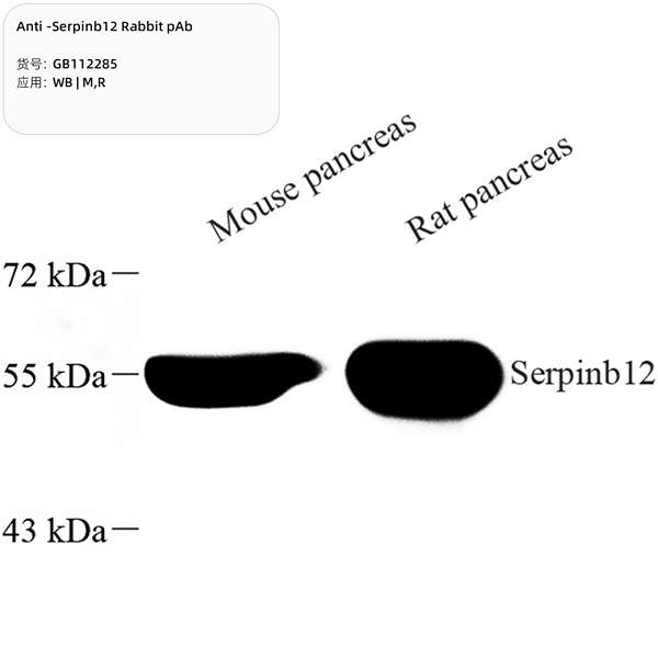 Антитела первичные, поликлональные, Serpinb12, 100 мкл