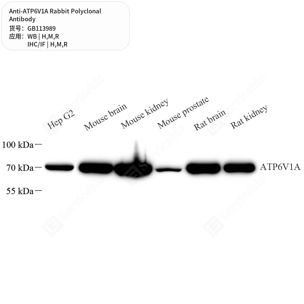 Антитела первичные, поликлональные кролика к ATP6V1A крысы, мыши, человека, 100 мкл