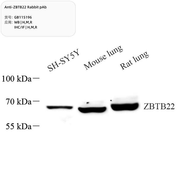 Антитела первичные, поликлональные, ZBTB22, 100 мкл