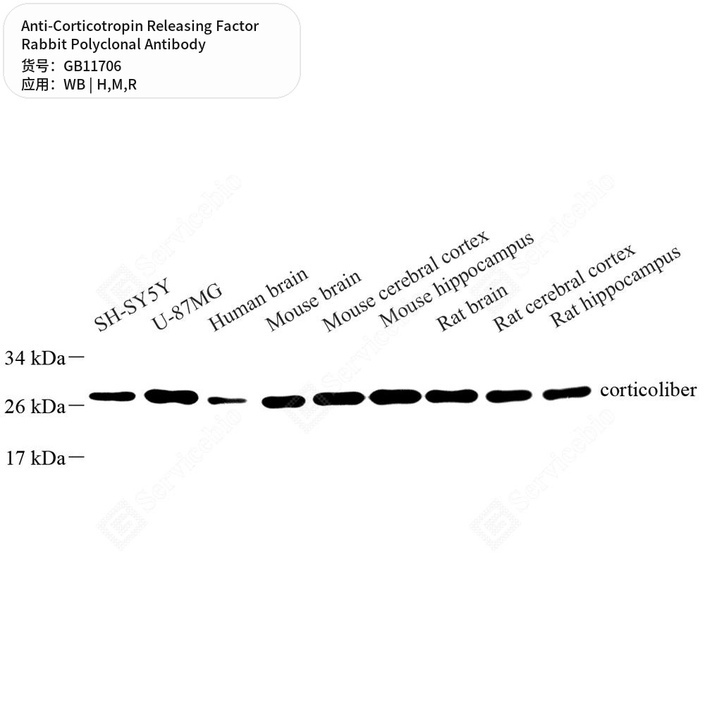 Антитела первичные, поликл. кролика к Corticotropin Releasing Factor крысы, мыши, человека, 50 мкл