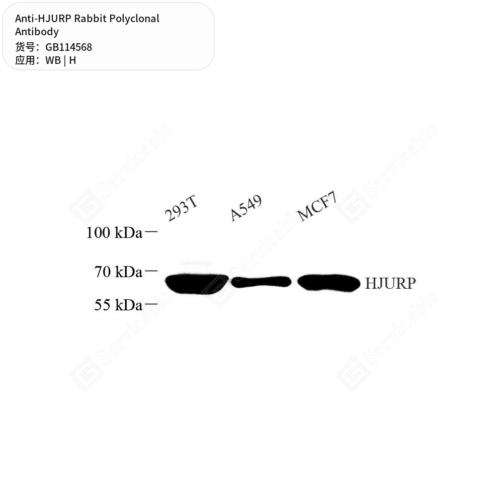 Антитела первичные, поликлональные кролика к HJURP человека, 50 мкл