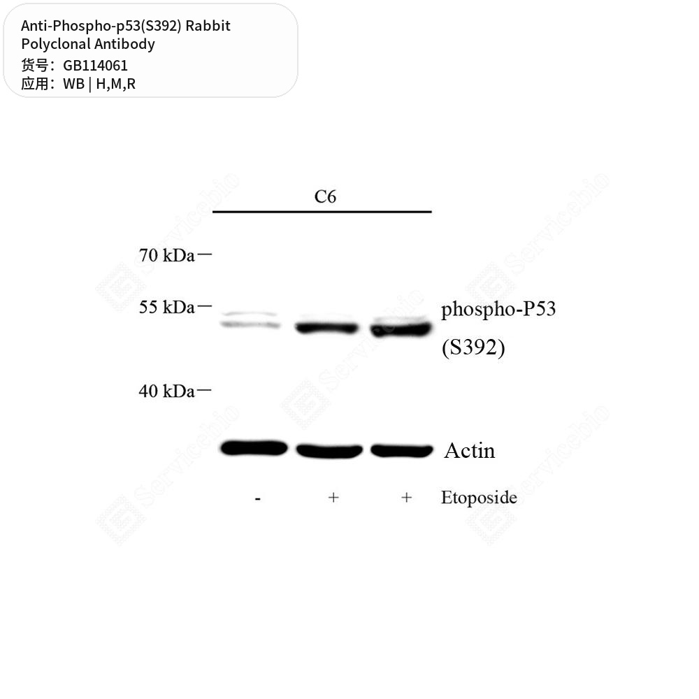Антитела первичные, поликлональные кролика к Phospho-p53(S392) крысы, мыши, человека, 50 мкл