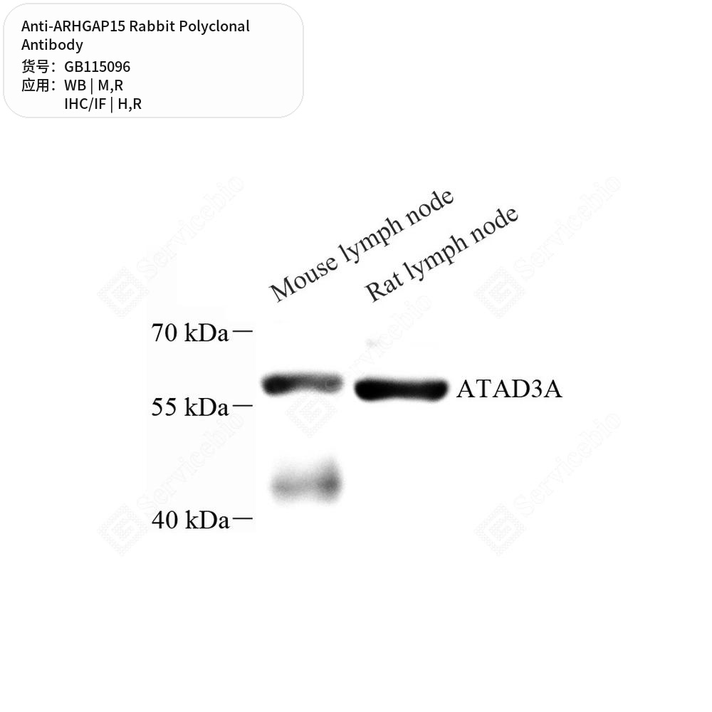 Антитела первичные, поликлональные кролика к ARHGAP15 крысы, мыши, человека, 50 мкл