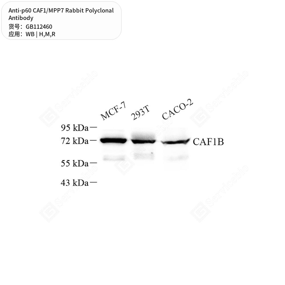 Антитела первичные, поликлональные кролика к p60 CAF1/MPP7 крысы, мыши, человека, 100 мкл