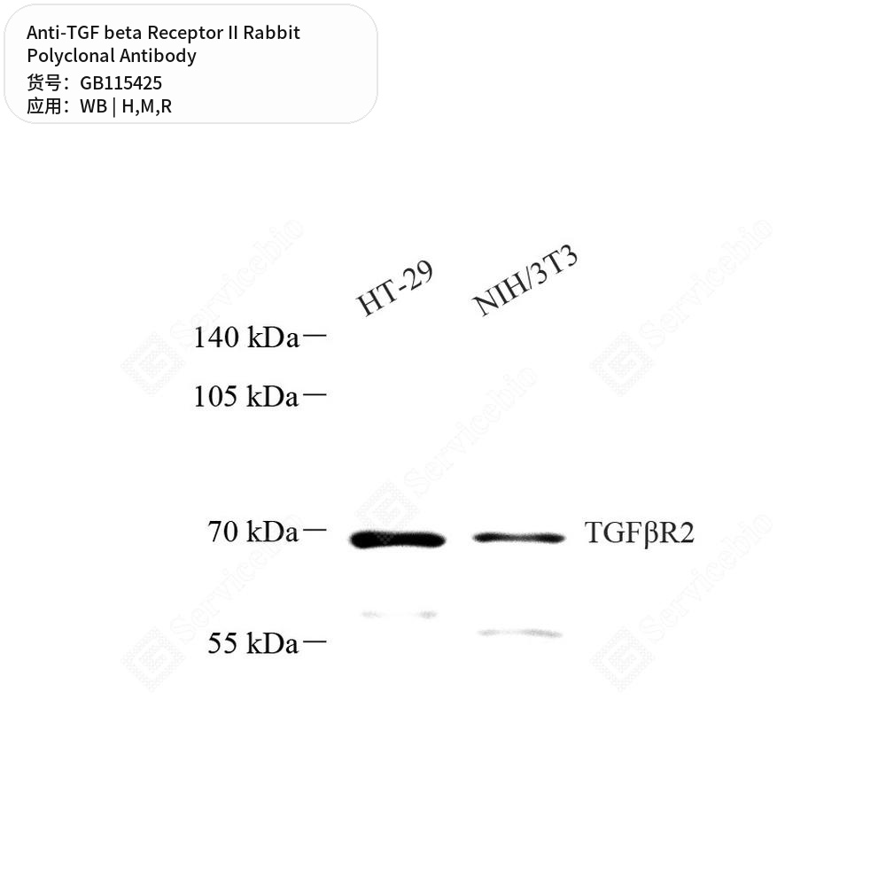 Антитела первичные, поликлональные кролика к TGF beta Receptor II крысы, мыши, человека, 50 мкл