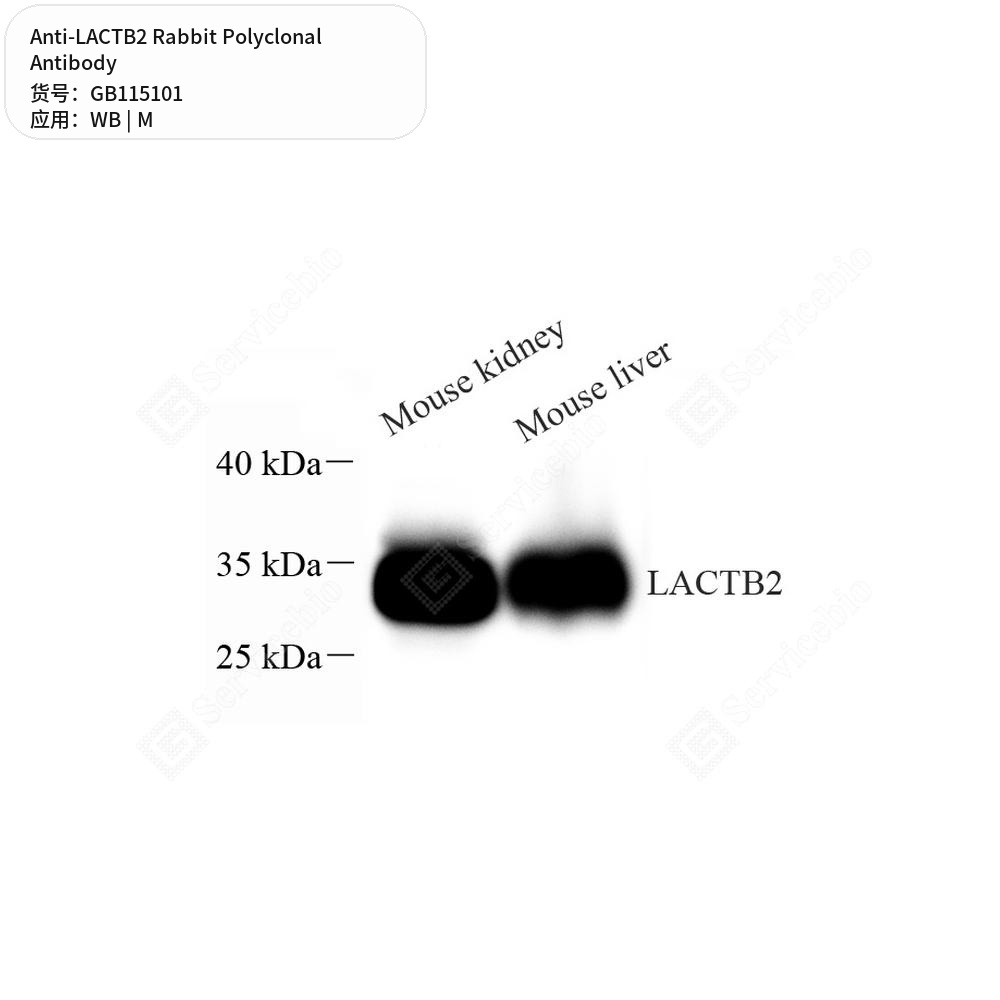 Антитела первичные, поликлональные кролика к LACTB2 мыши, 50 мкл
