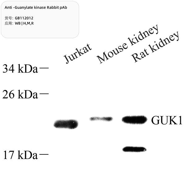 Антитела первичные, поликлональные, Guanylate kinase, 100 мкл