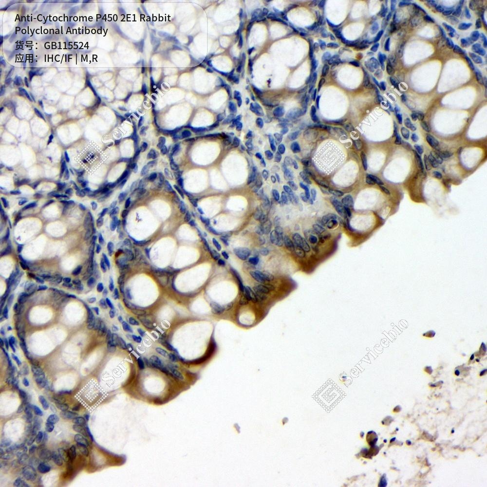 Антитела первичные, поликлональные кролика к Cytochrome P450 2E1 крысы, мыши, 50 мкл