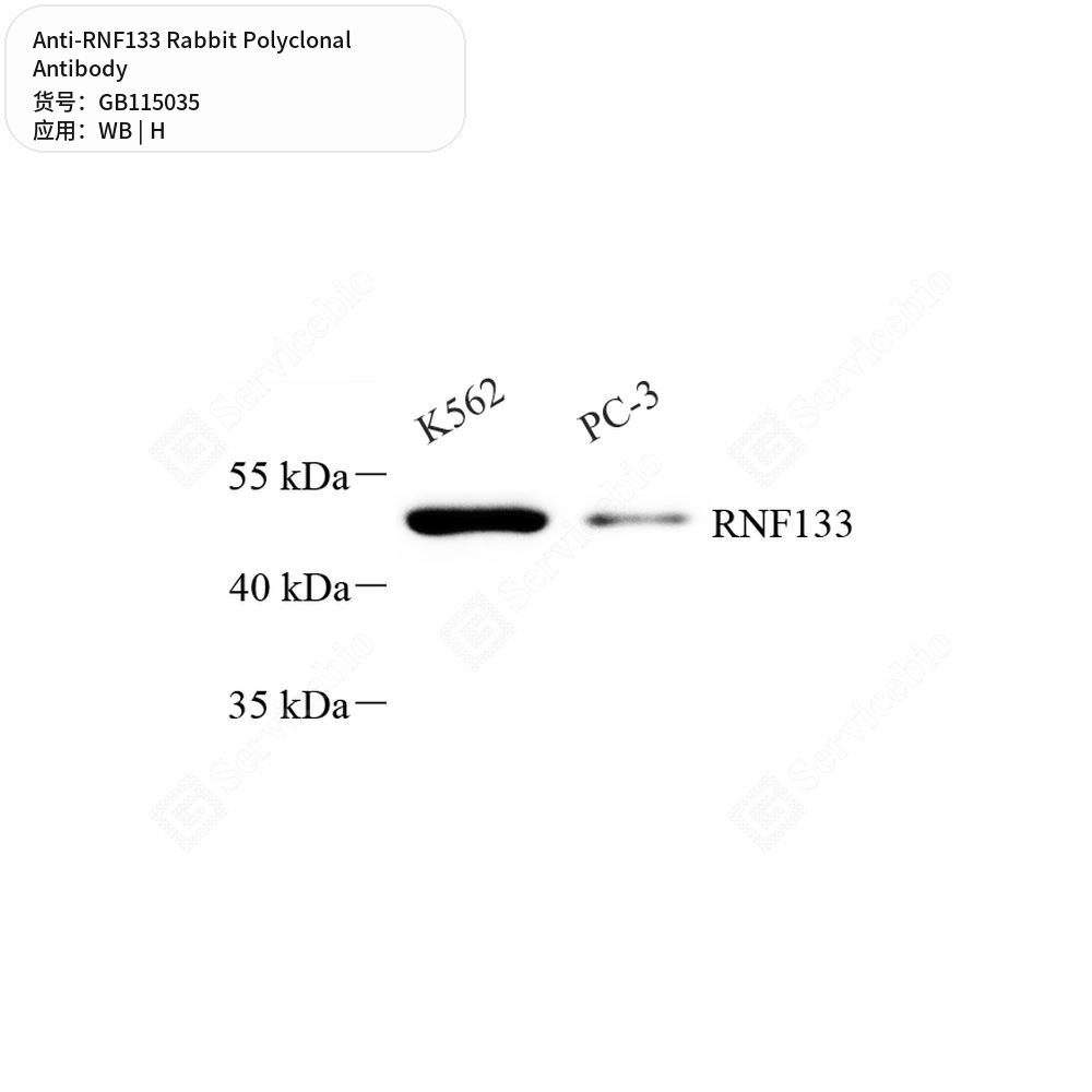 Антитела первичные, поликлональные кролика к RNF133 человека, 50 мкл