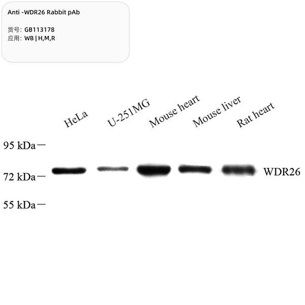 Антитела первичные, поликлональные, WDR26, 100 мкл