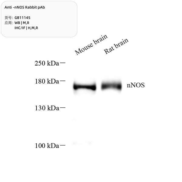 Антитела первичные, поликлональные, nNOS, 100 мкл