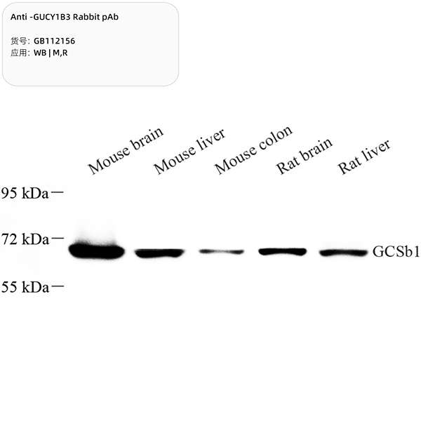 Антитела первичные, поликлональные, GUCY1B3, 100 мкл