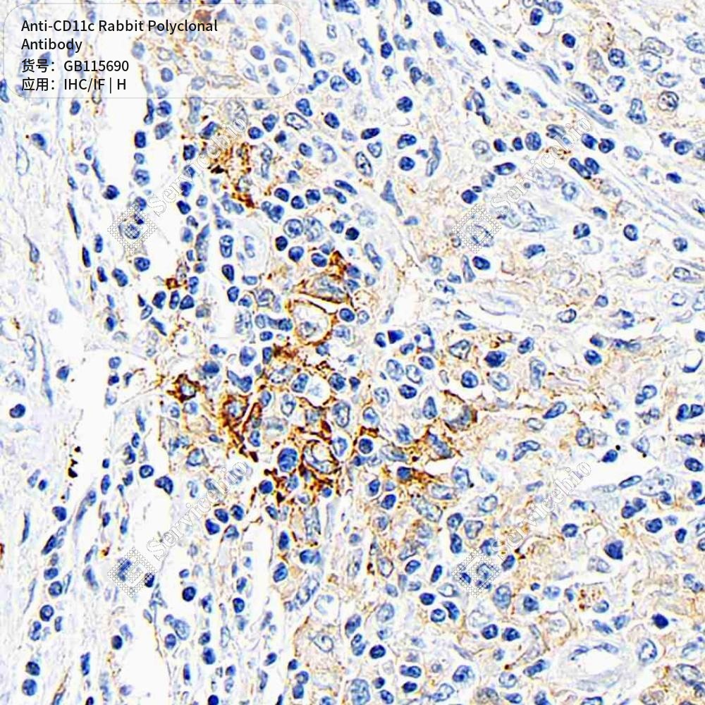 Антитела первичные, поликлональные кролика к CD11c человека, 50 мкл