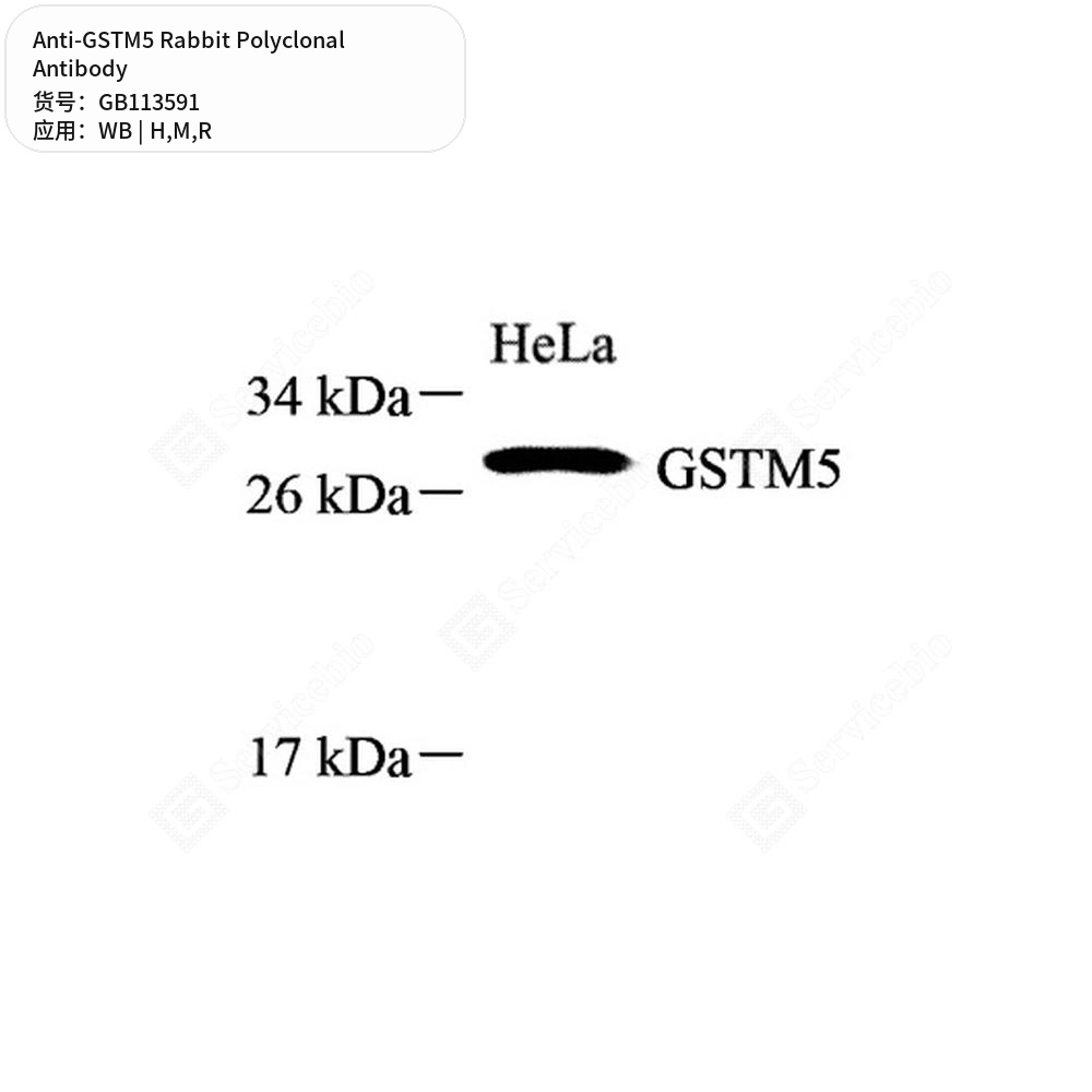 Антитела первичные, поликлональные кролика к GSTM5 крысы, мыши, человека, 50 мкл