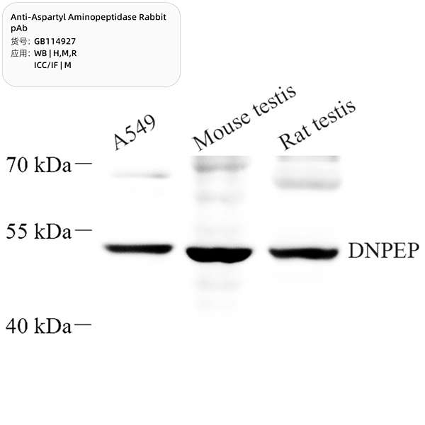 Антитела первичные, поликлональные, Aspartyl Aminopeptidase, 100 мкл