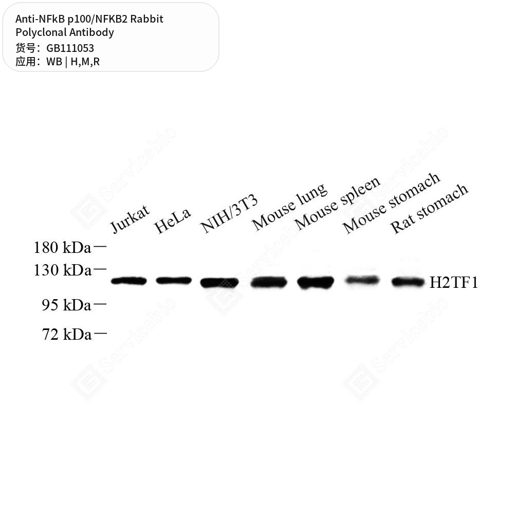 Антитела первичные, поликлональные кролика к NFkB p100/NFKB2 крысы, мыши, человека, 100 мкл