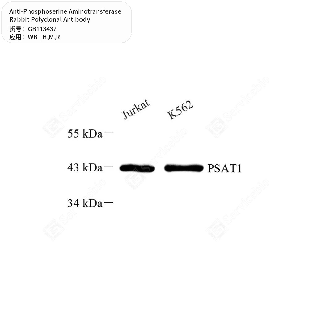 Антитела первичные, поликл. кролика к Phosphoserine Aminotransferase крысы, мыши, человека, 100 мкл
