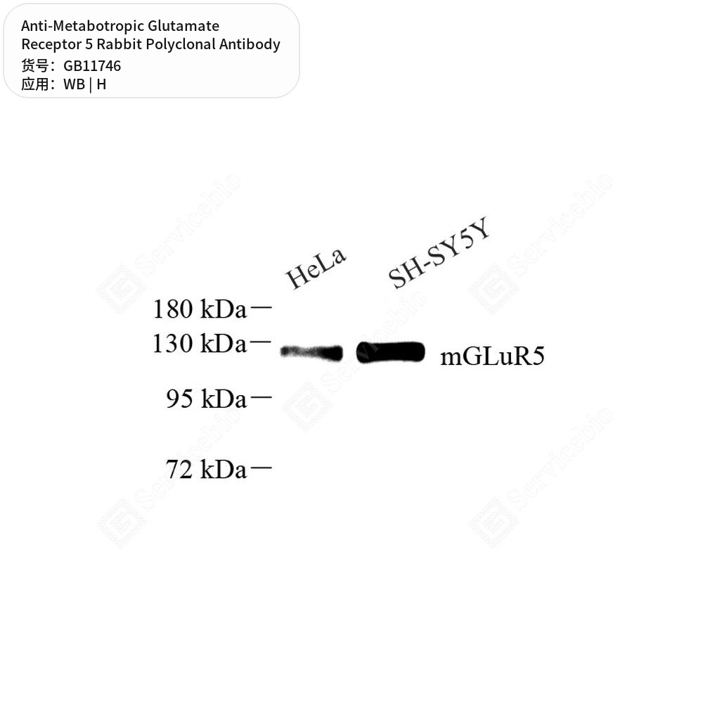 Антитела первичные, поликлональные кролика к Metabotropic Glutamate Receptor 5 человека, 50 мкл