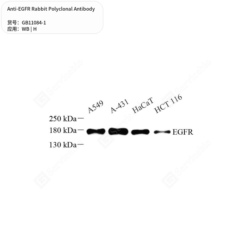 Антитела первичные, поликлональные кролика к EGFR человека, 100 мкл