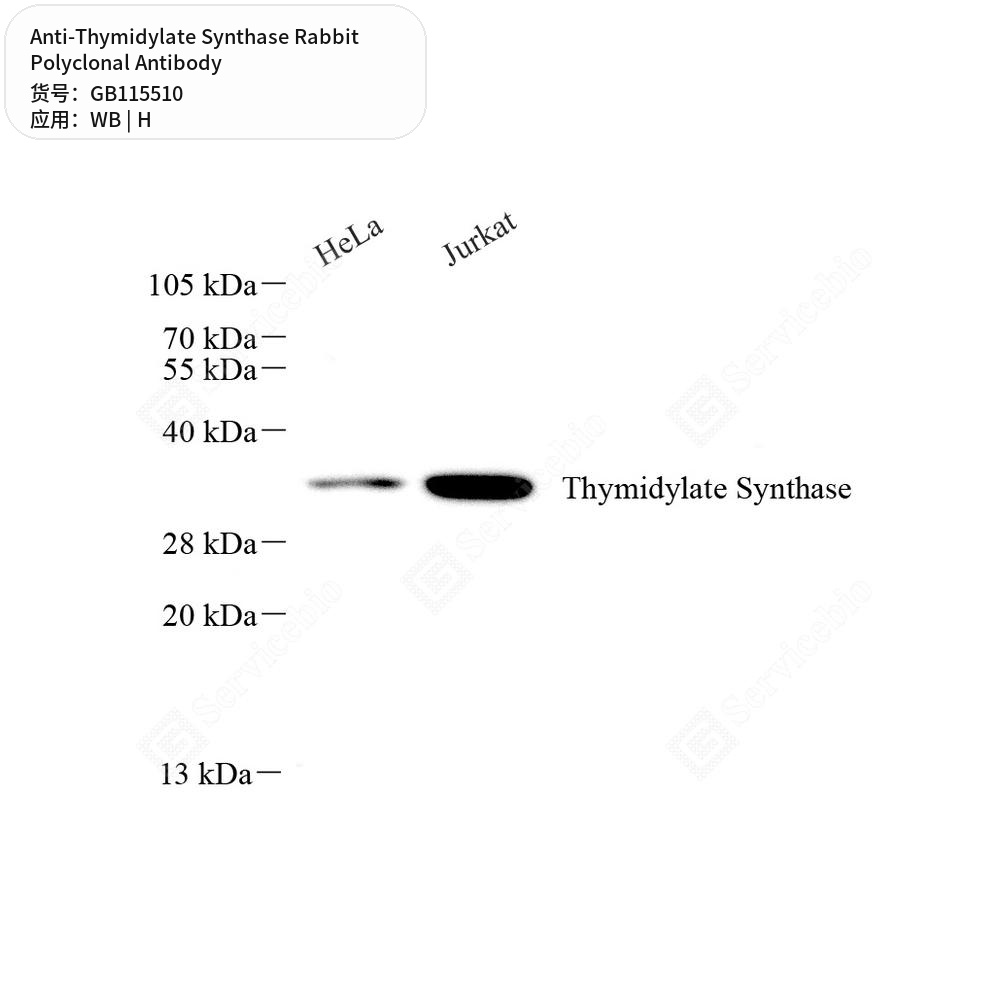 Антитела первичные, поликлональные кролика к Thymidylate Synthase человека, 50 мкл