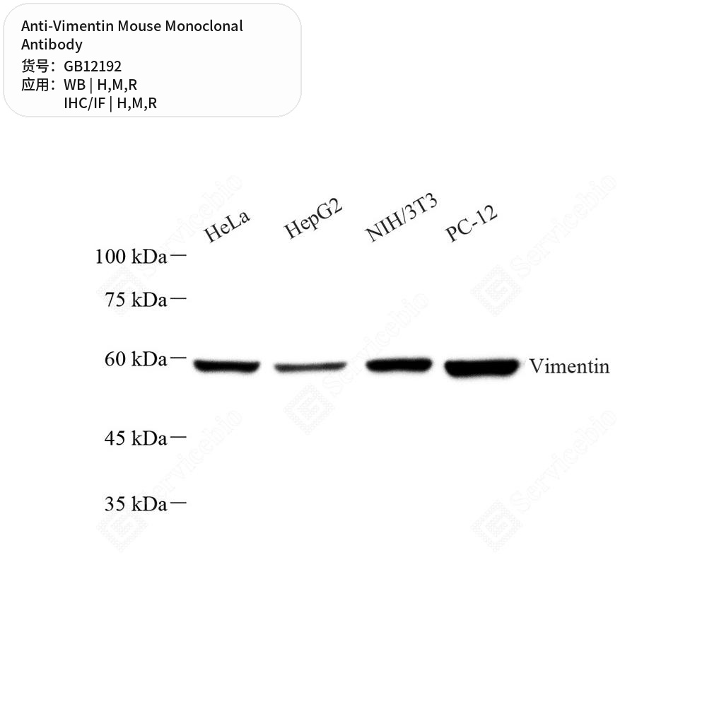 Антитела первичные, моноклональные мыши к Vimentin крысы, мыши, человека, 50 мкл