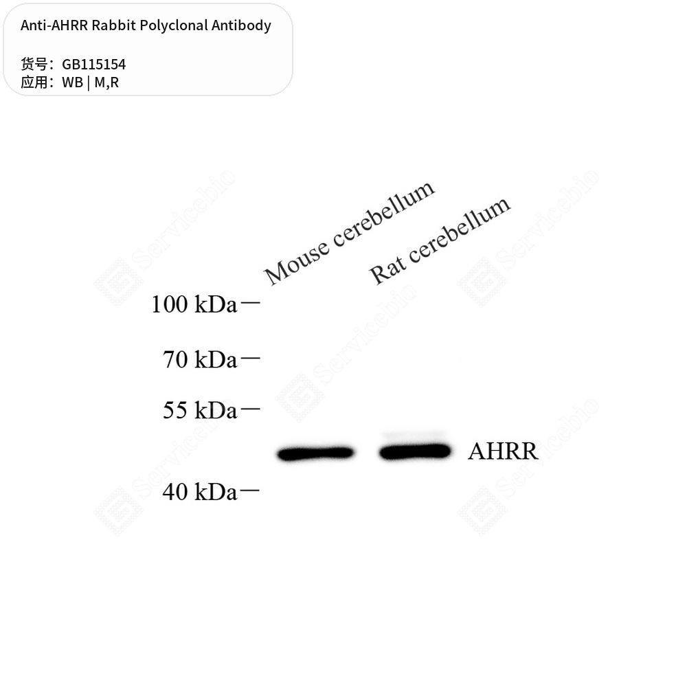 Антитела первичные, поликлональные кролика к AHRR крысы, мыши, 50 мкл