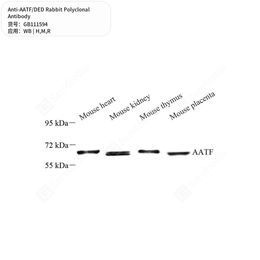 Антитела первичные, поликлональные кролика к AATF/DED крысы, мыши, человека, 100 мкл