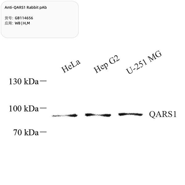 Антитела первичные, поликлональные, QARS1, 100 мкл
