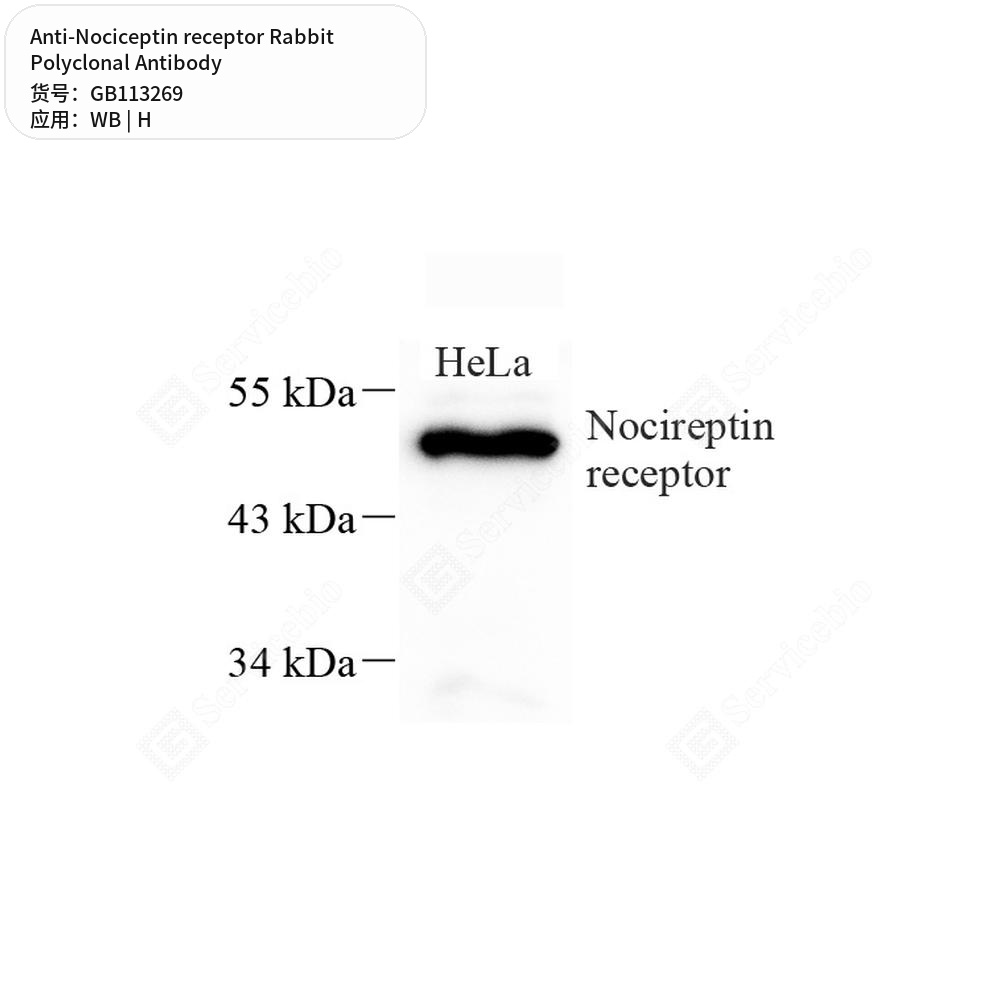 Антитела первичные, поликлональные кролика к Nociceptin receptor человека, 100 мкл