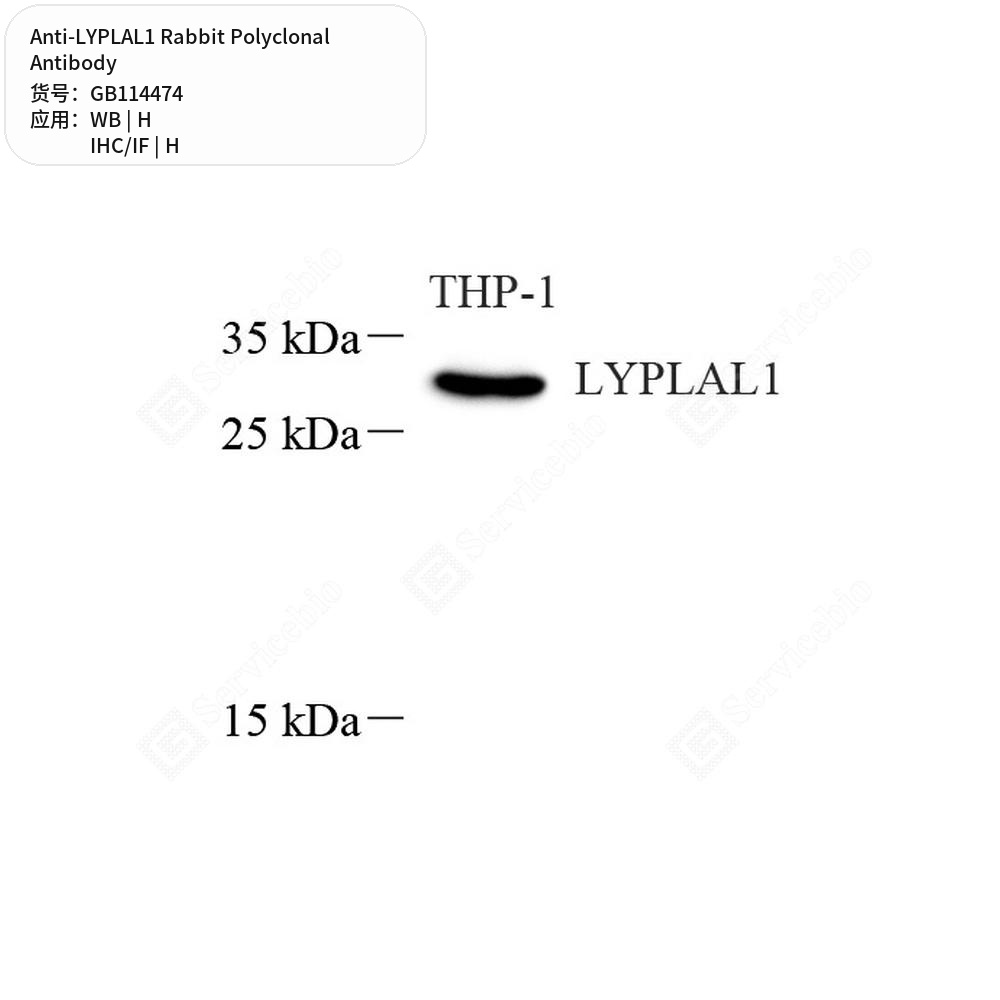 Антитела первичные, поликлональные кролика к LYPLAL1 человека, 50 мкл