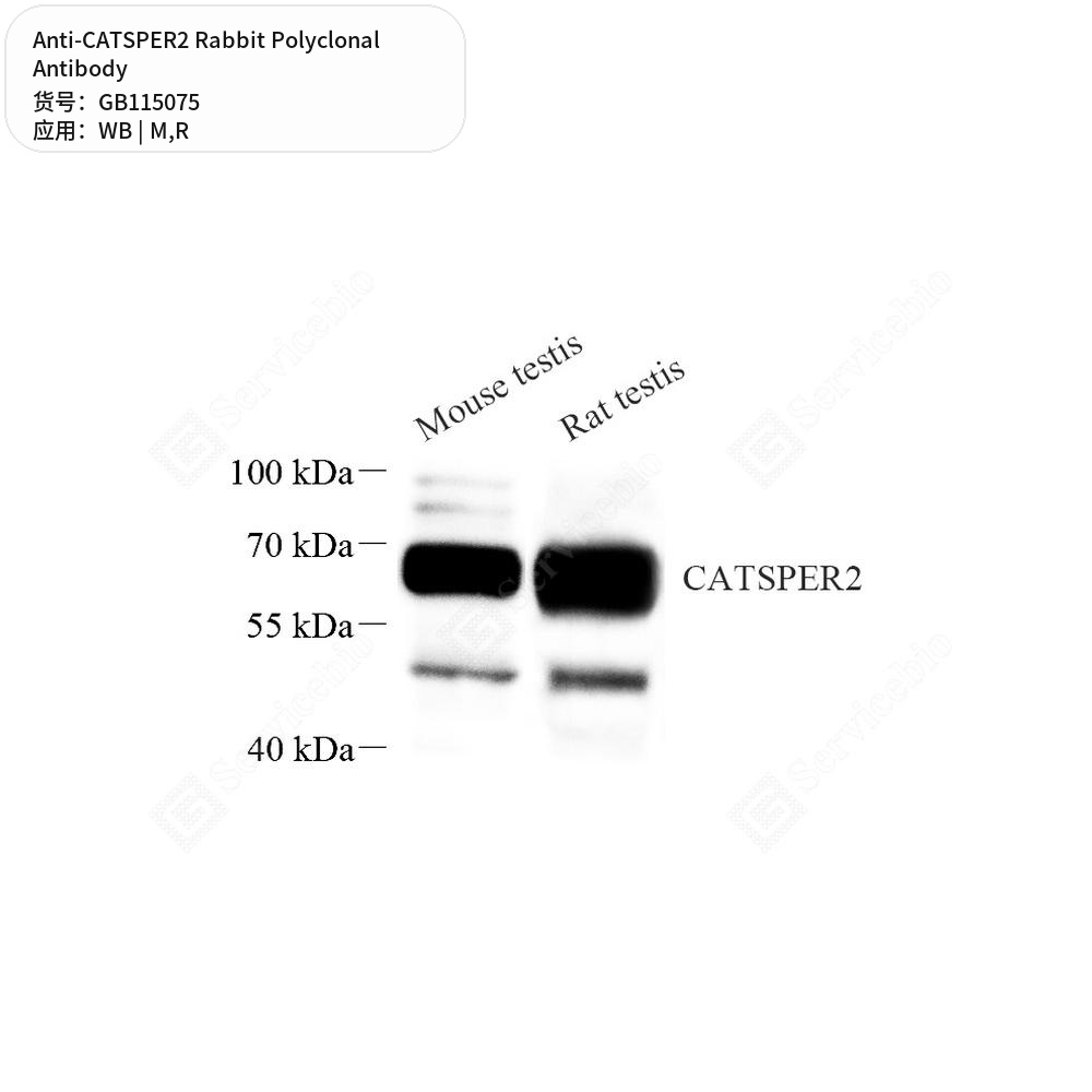 Антитела первичные, поликлональные кролика к CATSPER2 крысы, мыши, 50 мкл