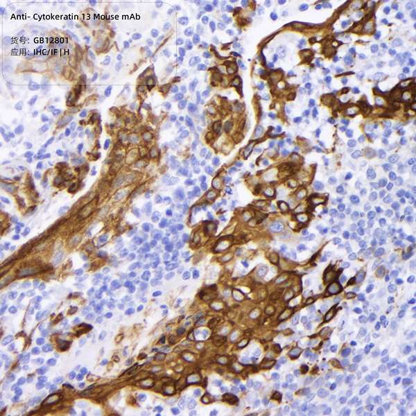 Антитела первичные, моноклональные, Cytokeratin 13, 100 мкл