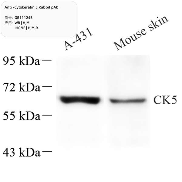 Антитела первичные, поликлональные, Cytokeratin 5, 100 мкл