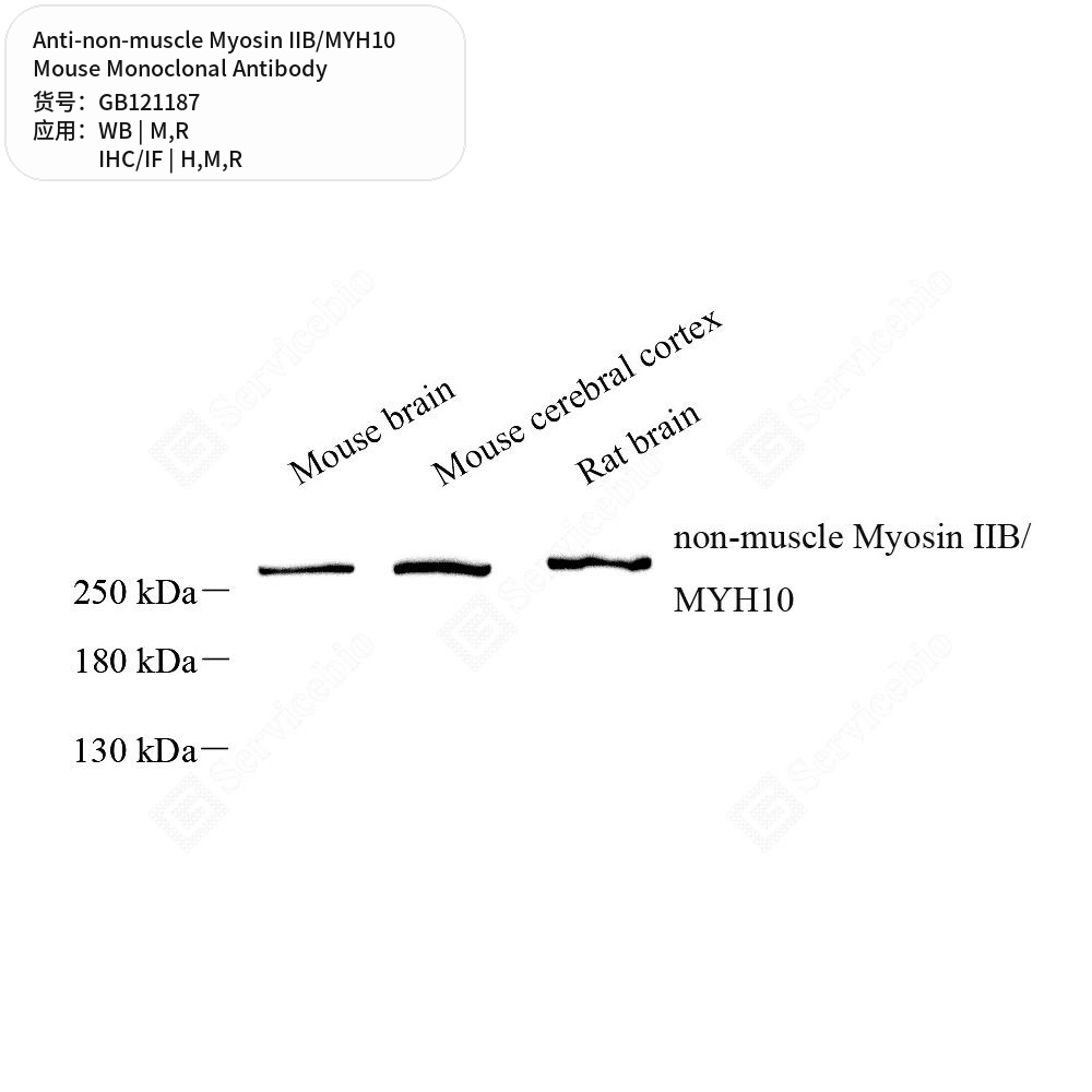 Антитела первичные, моноклональные мыши к non-muscle Myosin IIB/MYH10 крысы, мыши, чел., 100 мкл