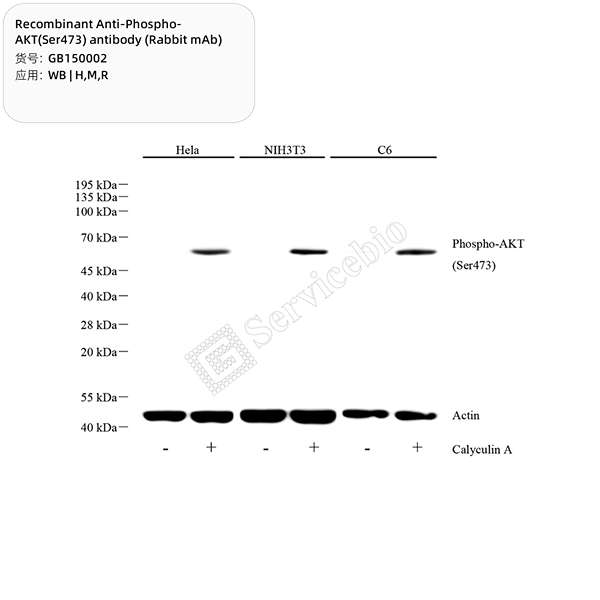Антитела первичные, моноклональные, Phospho-AKT(Ser473), 100 мкл