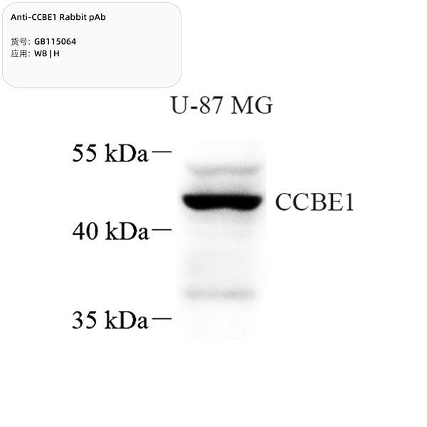 Антитела первичные, поликлональные, CCBE1, 100 мкл
