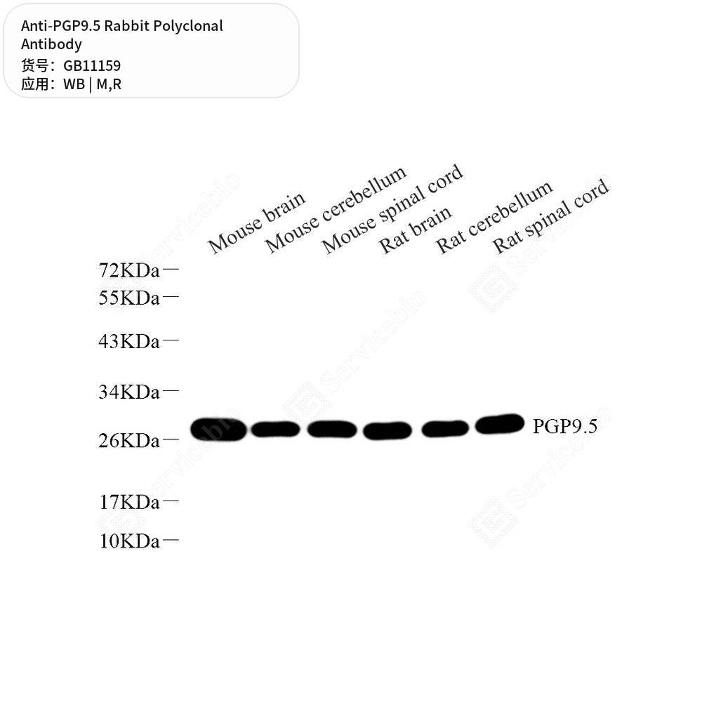 Антитела первичные, поликлональные кролика к PGP9.5 крысы, мыши, 100 мкл