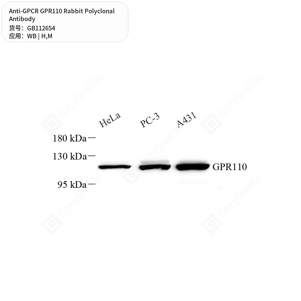 Антитела первичные, поликлональные кролика к GPCR GPR110 мыши, человека, 100 мкл