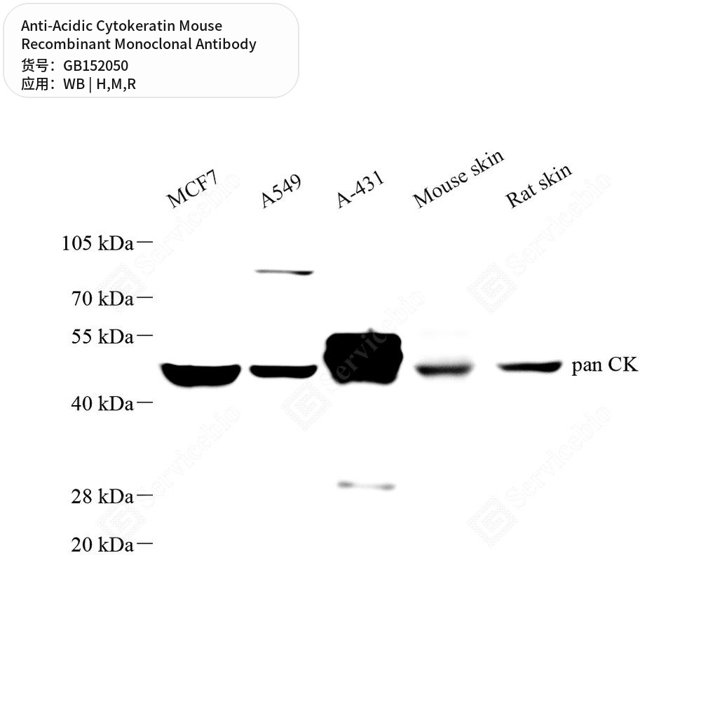 Антитела первичные, моноклональные мыши к Acidic Cytokeratin крысы, мыши, человека, 100 мкл
