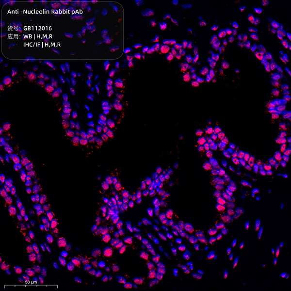Антитела первичные, поликлональные, Nucleolin, 100 мкл